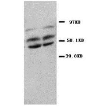 PP2A-alpha/PPP2CA/PP2A Rabbit Polyclonal Antibody