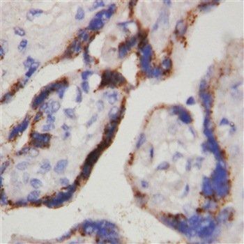 Beta-HCG CGB/HCG Mouse Monoclonal Antibody