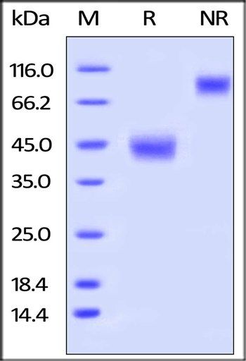Human LAP (TGF-beta 1) Protein, His Tag