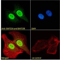 BAF53A and BAF53B Antibody