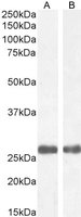 Goat anti-MBL2 / Mannan-Binding Lectin Antibody