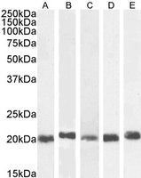 CBX3/HP1 Gamma Antibody