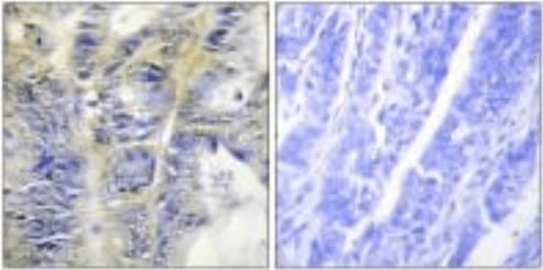 Collagen IV α5 Antibody