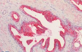 Goat anti-KLK2 Antibody