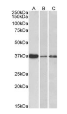Goat anti-IL12B / IL12p40 Antibody
