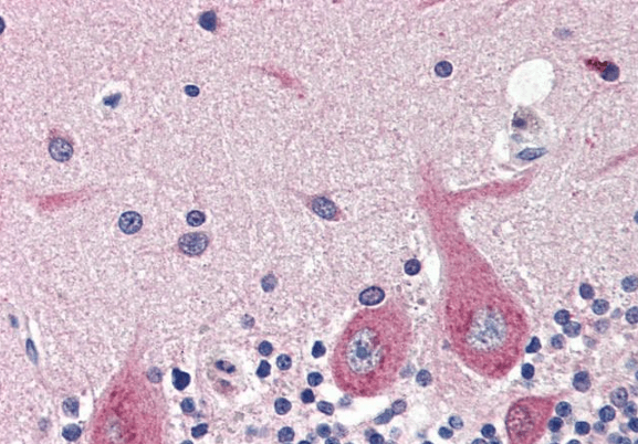 GAD1 (isoform GAD67) Antibody