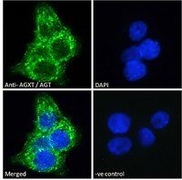 Goat anti-AGXT / AGT Antibody