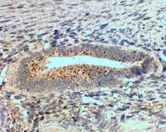 SFRP4 Antibody