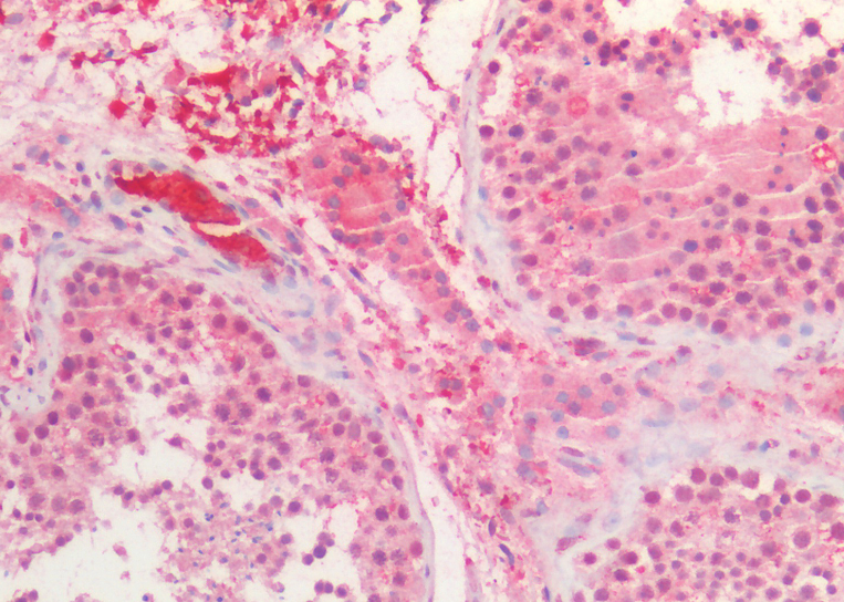 BMI1 (aa237-251) Antibody