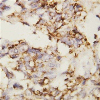 N-Cadherin-2 CDH2 CD325-/CD325 Rabbit Polyclonal Antibody