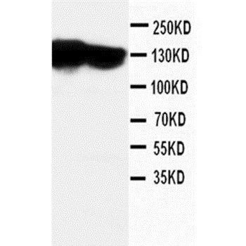 N-Cadherin-2 CDH2 CD325-/CD325 Rabbit Polyclonal Antibody