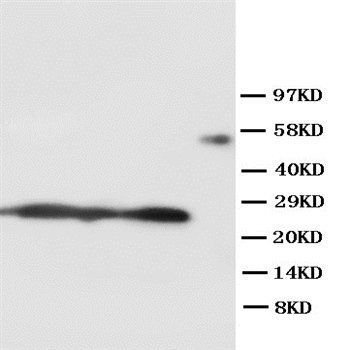 SFTPA1 Rabbit Polyclonal Antibody