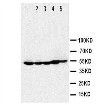 Histone deacetylase 2 HDAC2 Rabbit Polyclonal Antibody