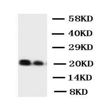 Interleukin-6 IL6 Rabbit Polyclonal Antibody