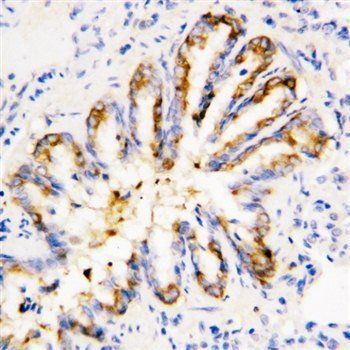 Calpain 1/CAPN1 Rabbit Polyclonal Antibody