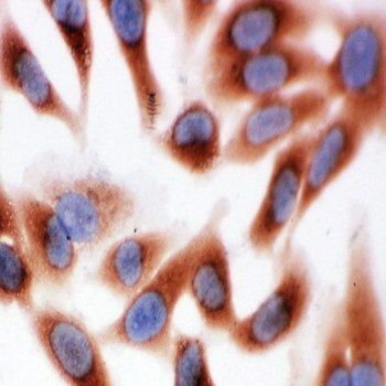 Calpain 1/CAPN1 Rabbit Polyclonal Antibody