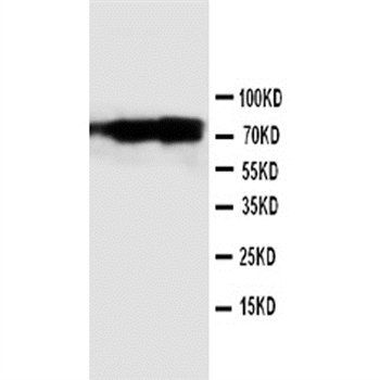 Calpain 1/CAPN1 Rabbit Polyclonal Antibody