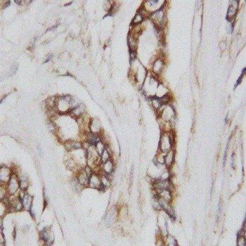 CDC42 Rabbit Polyclonal Antibody