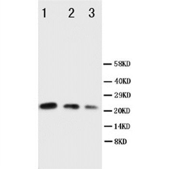 CDC42 Rabbit Polyclonal Antibody
