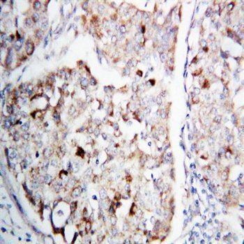 MEK1/MAP2K1 Rabbit Polyclonal Antibody