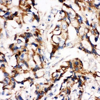 MEK1/MAP2K1 Rabbit Polyclonal Antibody