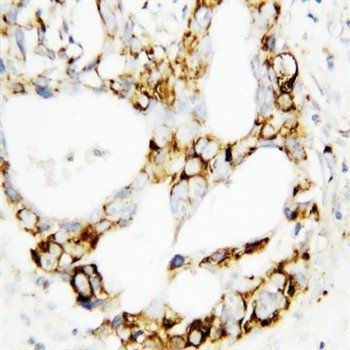MEK3/MAP2K3 Rabbit Polyclonal Antibody