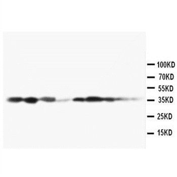 MEK3/MAP2K3 Rabbit Polyclonal Antibody
