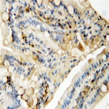 MAPK8/9 Rabbit Polyclonal Antibody