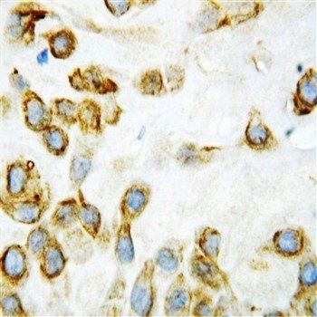 Thrombospondin 2/THBS2 Rabbit Polyclonal Antibody