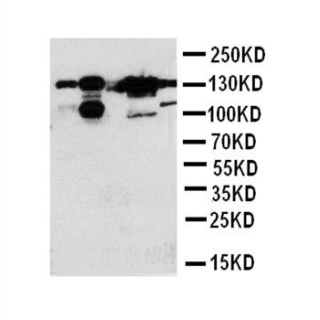 Thrombospondin 2/THBS2 Rabbit Polyclonal Antibody