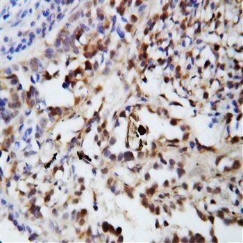 Ubiquitin/UBB Rabbit Polyclonal Antibody