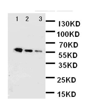Alpha-2-HS-glycoprotein AHSG/HS Rabbit Polyclonal Antibody