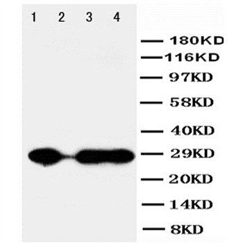 Carbonic Anhydrase I/CA1 Rabbit Polyclonal Antibody
