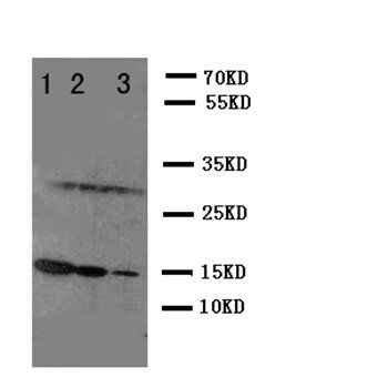 Interleukin-2 IL2 Rabbit Polyclonal Antibody