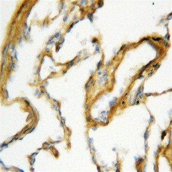 SFTPA1 Rabbit Polyclonal Antibody