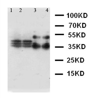SFTPA1 Rabbit Polyclonal Antibody