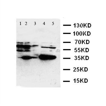 Fos B/FOSB Rabbit Polyclonal Antibody