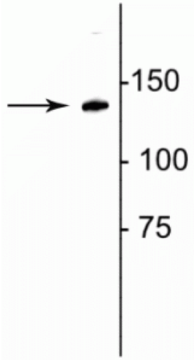 Anti-Collagen 1, alpha 1 telopeptide Antibody