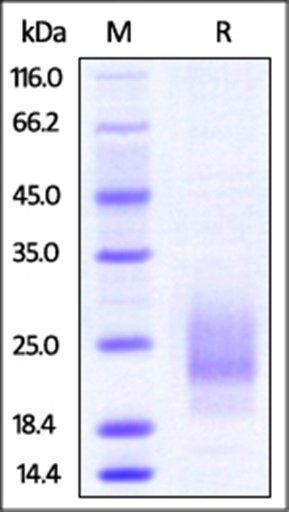 Mouse TIGIT Protein, His Tag