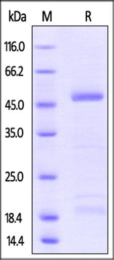 Zika Virus NS1 Protein, His Tag