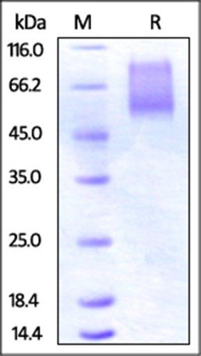 Human CX3CL1 Protein, His Tag