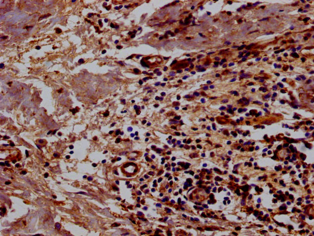 BCL11A Antibody