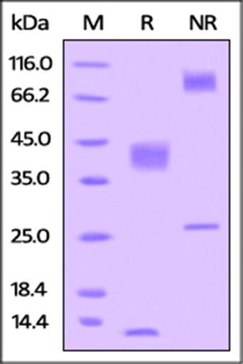 Human Latent TGF-beta 1 Protein, His Tag