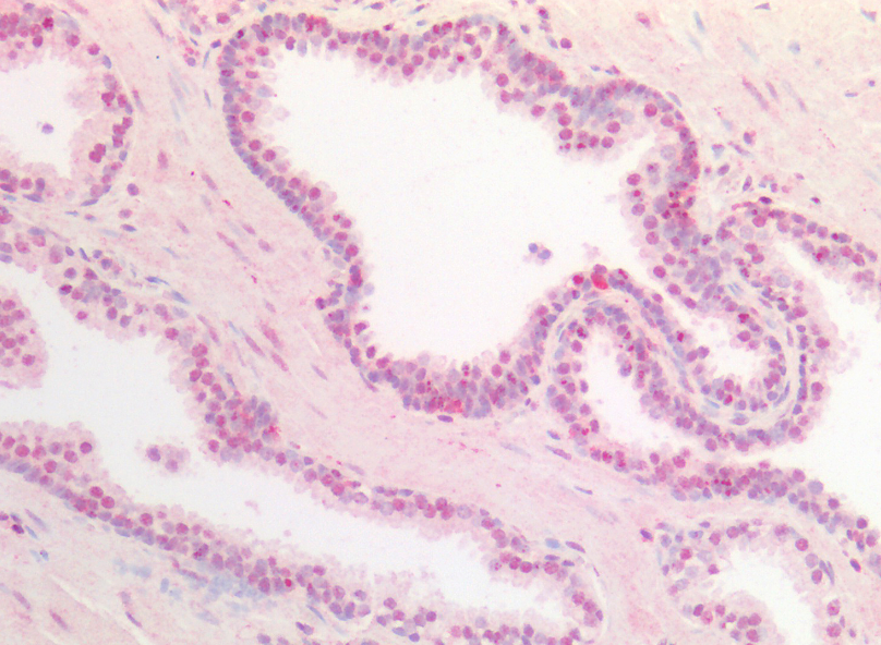 UBID4 (aa245-259) Antibody