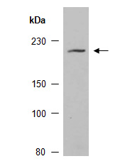 KDM5D (C1) Antibody, Rabbit Polyclonal