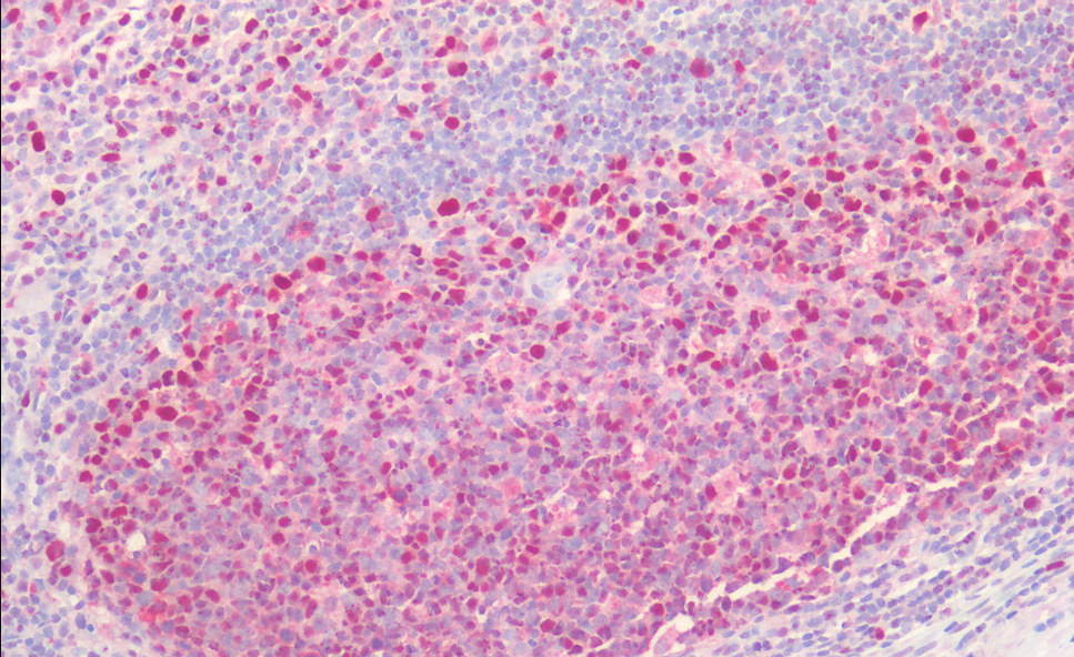 PCNA (aa111-122) Antibody