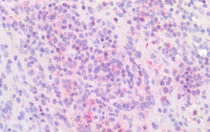 IRF4 (aa393-407) Antibody