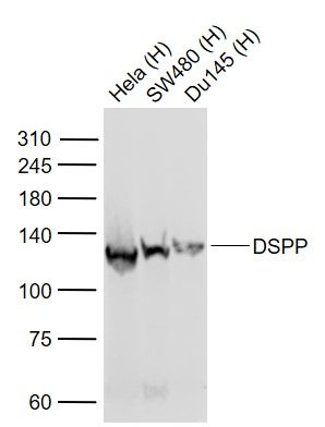 DSPP Rabbit Polyclonal Antibody (HRP)