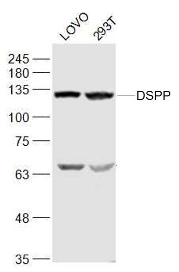 DSPP Rabbit Polyclonal Antibody (HRP)