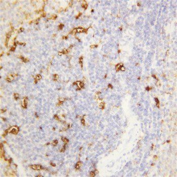 Alpha Amylase 1/AMY1A Rabbit Polyclonal Antibody